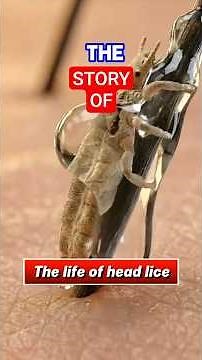 The Story of Head Lice Life