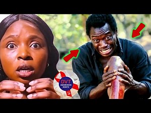 Deep Vein Thrombosis How to Prevent DVT: Doctor-Recommended Tips