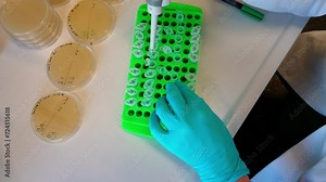 Pipetting bacterial colonies for sowing on solid nutrient media. High quality 4k footage