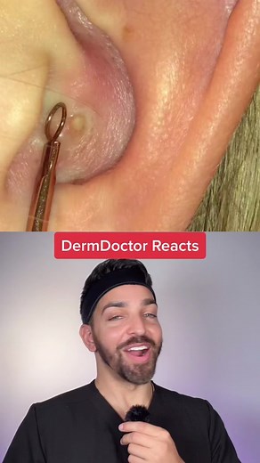 DermDoctor | Dr. Shah on TikTok