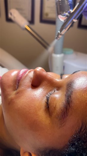 Piel Sana - Aesthetic Center - Laser Hair Removal on Instagram: "Tratamiento Oxygen en PielSana ✨ Un facial enfocado en mejorar la apariencia de la piel y aportar una sensación de frescura y confort. Se adapta a las necesidades de cada tipo de piel como parte de nuestros protocolos personalizados. Disponible bajo evaluación previa Agenda tu cita #PielSana #OxygenTreatment #FacialCare #AestheticCenter #SkinCareNYC #QueensAesthetic"
