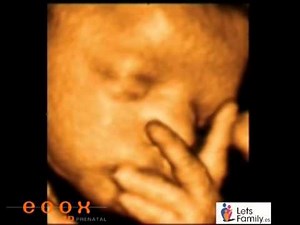 Todo lo que debes saber sobre la ecografía de las 34 semanas de embarazo: Desvelando los secretos del desarrollo fetal - Bambinos web