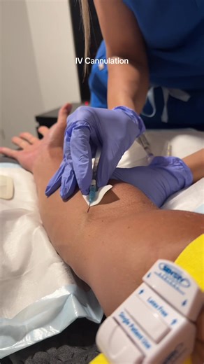 Step-by-Step Guide to IV Cannulation