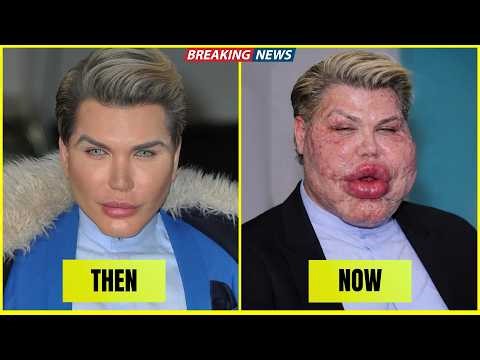 15 Celebrities Before and After Plastic Surgery | Then and Now 2026