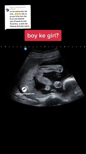 Ultrasound Images of an 18-Week-Old Fetus