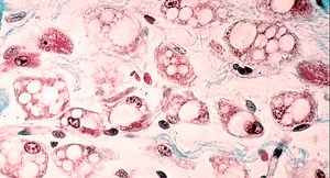 Towards an Understanding of the Role of Brown fat in Health and Disease | Cell And Molecular Biology