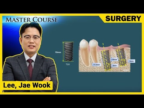 [Master Course Season2 - SURGERY] Immediate placement in the posterior region