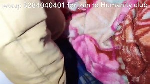 51K views · 557 shares | ਇਹ ਮਾਤਾ ਅੱਗ ਨਾਲ ਸੜ ਗਈ 15 ਦਿਨ ਤੋ ਘਰੇ ਗਲ ਰਹੀ ਪੈਸੇ ਇਲਾਜ ਬਿਨਾ....... for help- (Navtej Singh.. a/c. 50200018331430.. IFSC Code -: HDFC0000641 , swift code-HDFCINBB ), Branch City Batala . My add. dharmpura coloney, plot no. 50/2 , Batala pin code 143505 , wtsup 8284040401 | Navtej Humanity - Group of Hospitals' | Facebook