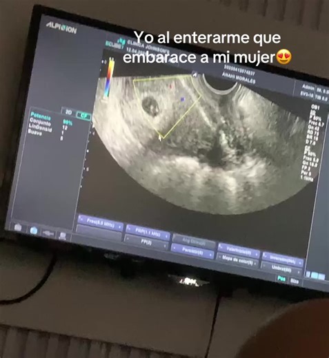 @Alejandra ❤️‍🩹 🐣😍