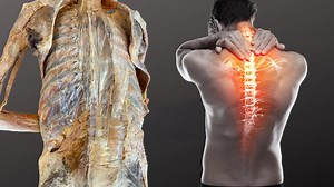 The hidden causes of back pain