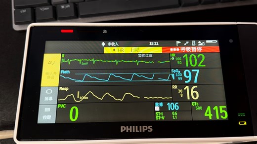 飞利浦监护仪 Intellivue X3 呼吸暂停警报