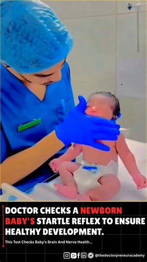 6.3K views · 61 reactions | 易 Doctor checks a newborn’s startle reflex a simple test to assess brain and nerve health for proper development. 喙✨ #newborncheck #babyhealth #startlereflex #neurocheck #doctorlife #babygrowth #pediatriccare #healthybaby | Dr Pranav Sharma | Facebook