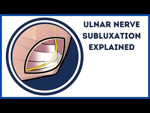 Ulnar Nerve Subluxation / Snapping Ulnar Nerve Explained