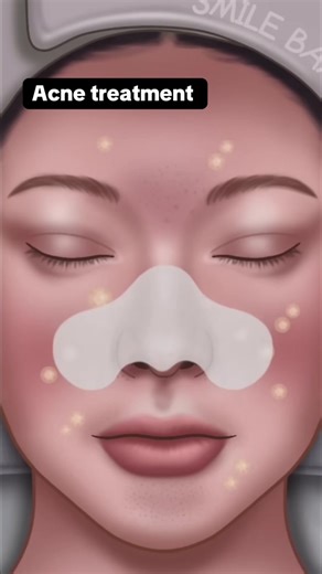 makeover transformation .. animation videos asmr animation treatment relaxing asmr animation animation asmr #storytimeasmr #asmrmakeupanimation #animationasmr