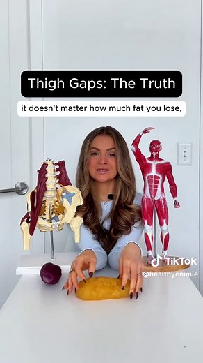 Understanding Thigh Gaps in Women's Health