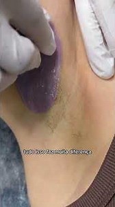 Why Your Client's Skin Gets Red AFTER Waxing #waxing #shorts