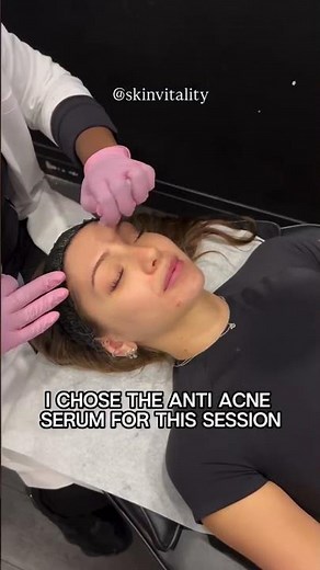 DP4 Microneedling Patient Review | Sarah’s Real Results at Skin Vitality