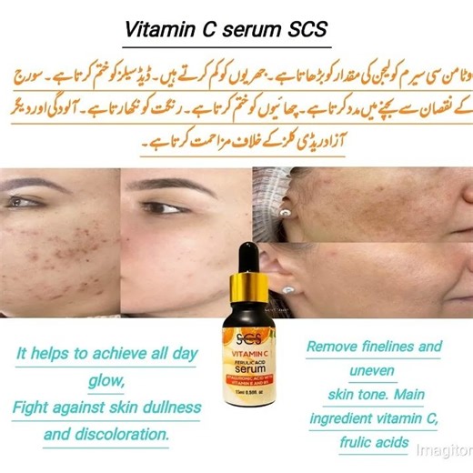 vitamun C F.W of SCS
