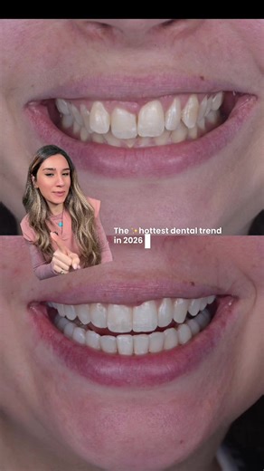 Benefits of Invisalign and Composite Bonding in London