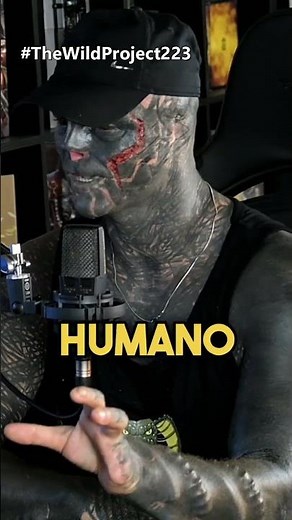 ¿Se amputará una pierna? Black Alien Project y su fascinación por el transhumanismo