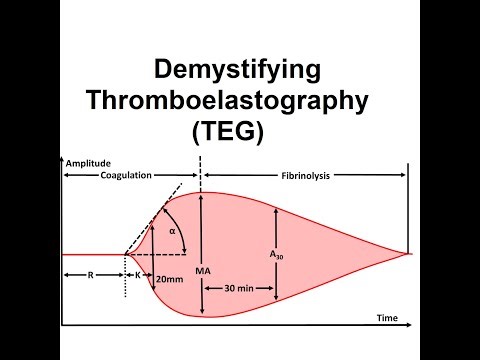 Demystifying Thromboelastography (TEG)