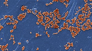 Staphylococcus aureus bacteria turns immune system against itself