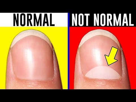 10 Signs You're Actually Normal..