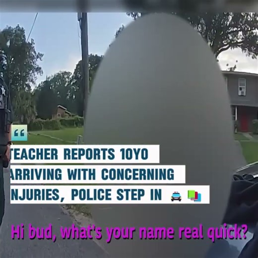 Teacher Reports 10yo Arriving With Concerning Injuries, Police Step In 🚔📚 A teacher notices a child showing visible signs of harm and immediately alerts authorities. Officers respond to ensure the student’s safety while school staff work closely with them to understand what happened. The case underscores how early reporting can protect vulnerable children and prevent further danger. Stay informed and learn why speaking up can make a life-changing difference. #ChildSafety #CommunityAwareness #P