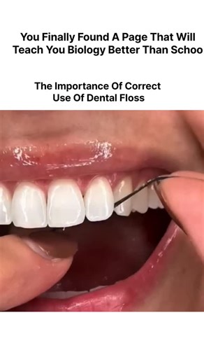 explaining. biology on Instagram: "Clinical Significance of Interproximal Oral Hygiene Effective oral care requires more than surface cleaning. While brushing addresses the accessible planes of the teeth, dental flossing is essential for reaching interproximal areas where a toothbrush cannot penetrate. Preventative Benefits of Flossing Debris and Biofilm Removal: Correct flossing technique effectively eliminates trapped food particles and plaque from between the teeth. Disease Prevention: Regula