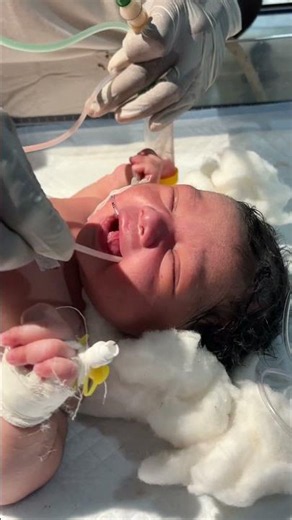 So baby saction process in nicu 😊👍 #youtubeshorts #anmnursing #viralvideo #newbornbaby #sacribe