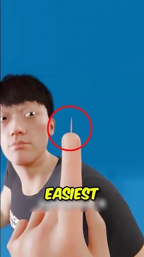 Never Pull Out a Splinter Like This! 😱🩹