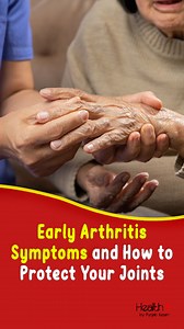 Early Arthritis Symptoms and How to Protect Your Joints #jointpain #arthritisawareness #healthtips | Health