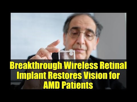 Breakthrough Wireless Retinal Implant Restores Vision for AMD Patients