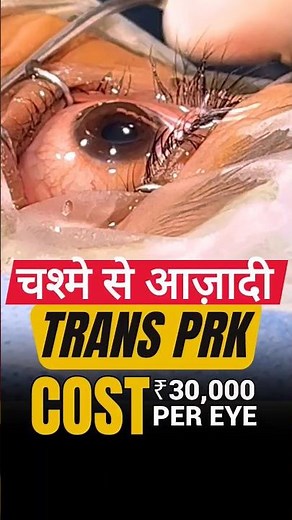 Trans Prk Eye Surgery I Procedure & Cost