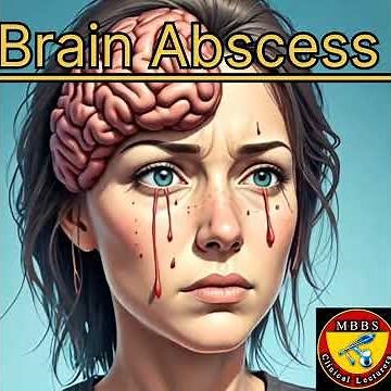 Brain Abscess it's causes sign and symptom diagnosis treatment prevention and control #brain #facts