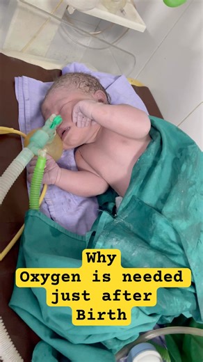 Neonate O2 importance #cpr #oxygen #foryou #neonatologist #trending#viral#shorts#resuscitation#apgar