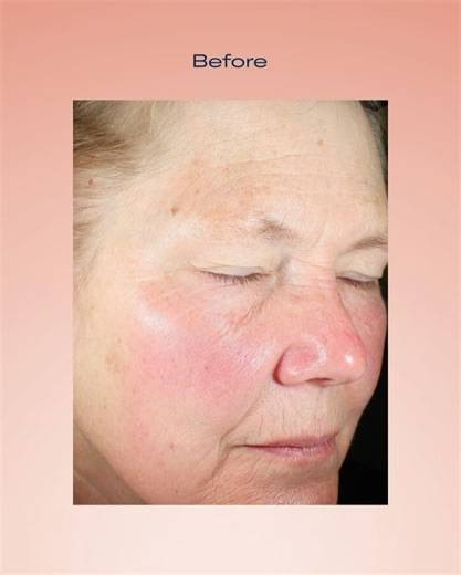 skinbetter science on Reels