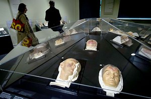 Syphilis in Deutschland auf dem Vormarsch: Höchststand bei Syphilis-Diagnosen