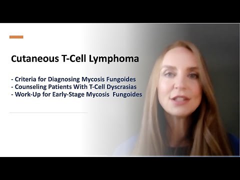 CTCL: Criteria to Diagnose, Counsel Patients, and Work-Up for Early-stage Mycosis Fungoides