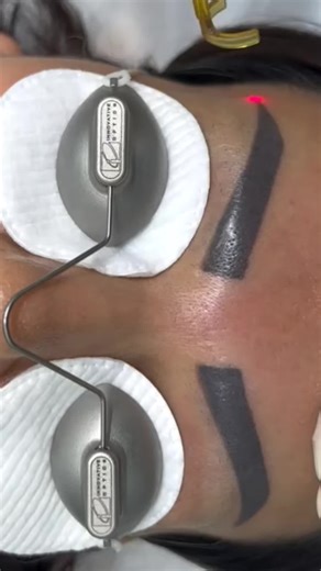 السلام عليكم ورحمه الله وبركاته مشاركه المنشور فضلا لنتقاسم الاجر فالدال علي الخير كفاعله بمناسبه شهر الله الحرام واقتراب شهر رمضان: نأخذ يوميا ١٠ جلسات منهم مجانيه وتكلفه مخفضه وخصومات نساعد بعض لعل وعسى الله يغفر لنا ولكم. #ازاله_الوشم_في_مصر ------ للتواصل اتصال او واتساب 01091271179 --- العنوان 304 د الدور الاول حدايق الاهرام شارع الضغط البوابه التانيه الجديده في الهرم، محافظه الجيزه ، مصر -------- المواعيد :من 9 صباحا ل 3 العصر للنساء من 4 العصر ل 9 مساءا للرجال ... #tattooremoval #توبه #اس