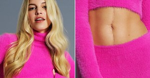 EXCLUSIEF. Actrice Bab Buelens (28) toont haar buik. “Vanaf het eerste moment vond ik mijn litteken mooi”