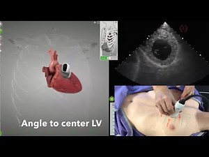 Focused Echo Training