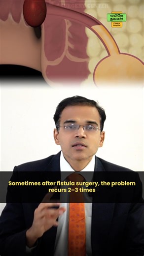 ⚠️ Recurrent fistula? Here’s how surgery can help! | The Ashok Doctor