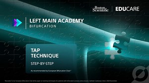 TAP Bifurcation Step by Step Technique Video