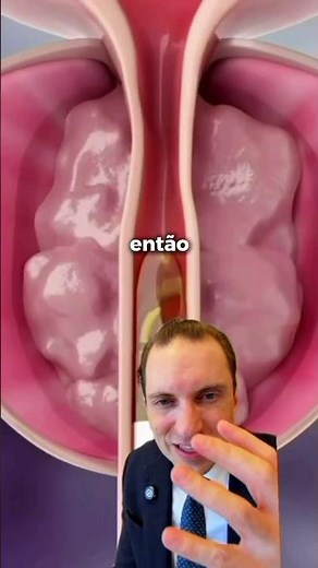 Olha só essa técnica para reduzir a próstata