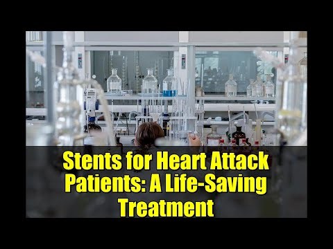 Stents for Heart Attack Patients: A Life-Saving Treatment