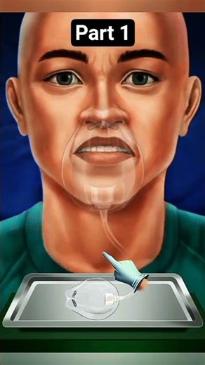 surjery#lego #health #hospital #animation #help