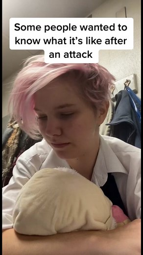 After a tic attack|| This was filmed before my tics and the attacks got worse, but it was still a lot on my body. || #tourettes #tics #ticsandtourettes #ticdisorder #fyp #foryou #tourettesawareness #ticattack