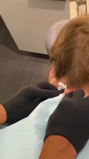 Doc Pimple Popper (@pimplepoopper)’s videos with original sound - Doc Pimple Popper
