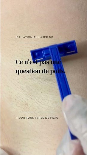 L’épilation au laser c'est question de confort et de confiance